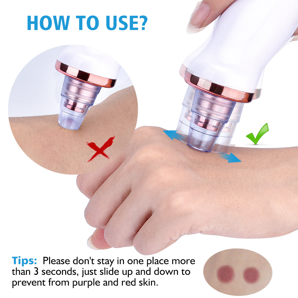 Blackhead Instrument