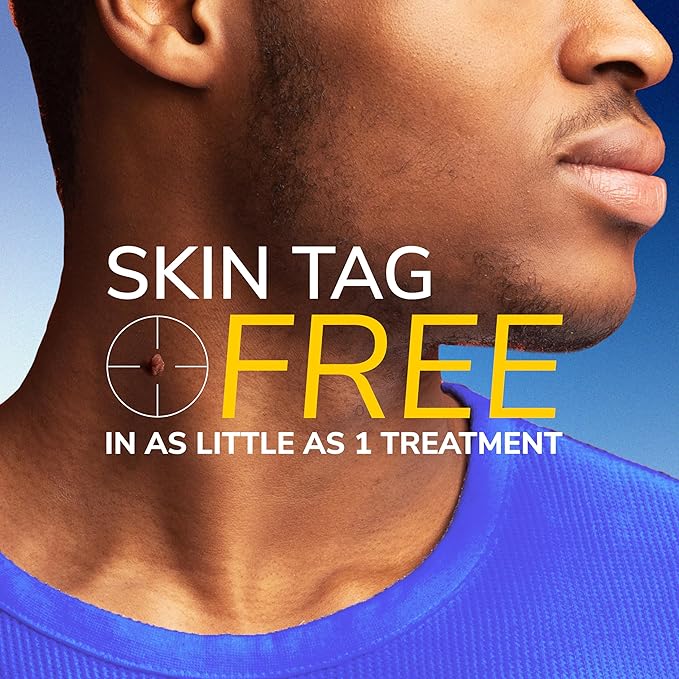 Skin Tag Remover Kit